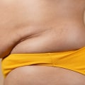 How Continuing Education and Certifications Can Help You Find the Right Tummy Tuck Surgeon