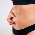 Tips for Preparing for a Tummy Tuck Surgery