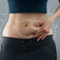 The Essential Guide to Post-Operative Instructions for Tummy Tuck Surgery