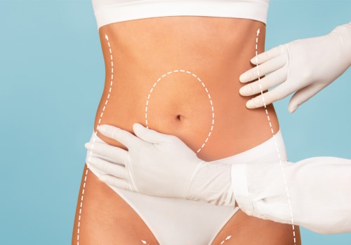 Areas of the Body That Can Be Treated: A Comprehensive Guide to Body Contouring Procedures