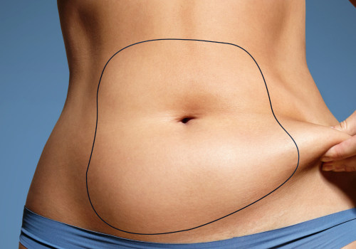 A Comprehensive Look at Liposuction Before-and-After Photos