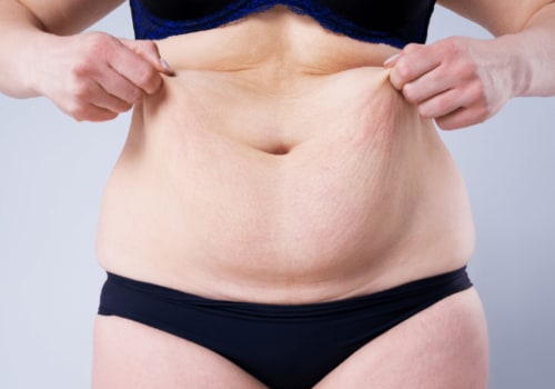 Qualifications and Certifications for Tummy Tuck Surgeons