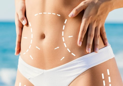 Types of Liposuction: A Comprehensive Guide to Body Contouring Procedures